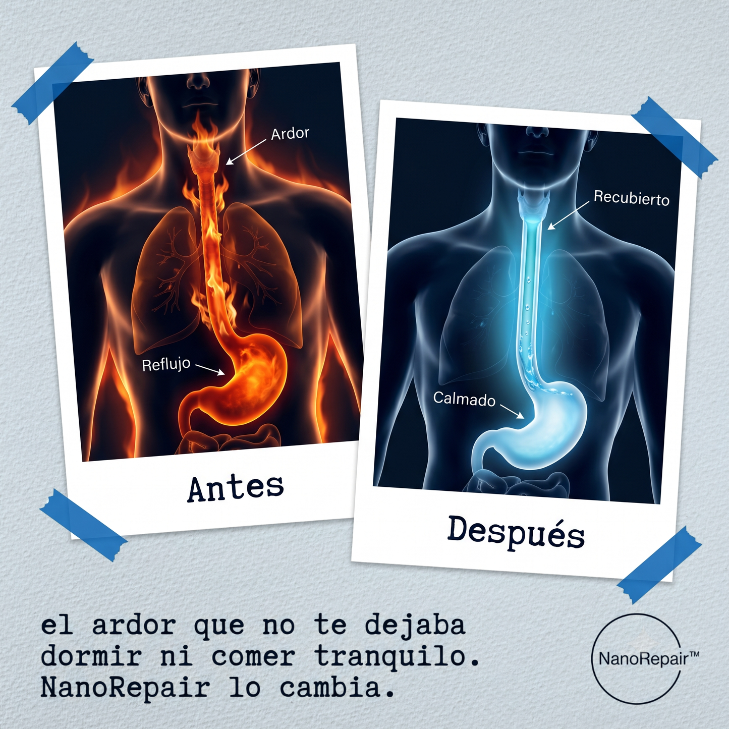 NanoRepair™ — Reparación Esofágica con Nanotecnología